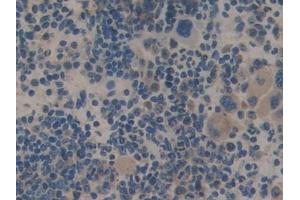 Immunohistochemistry (IHC) image for anti-TNF Receptor-Associated Factor 2 (TRAF2) (AA 238-491) antibody (ABIN7443455)