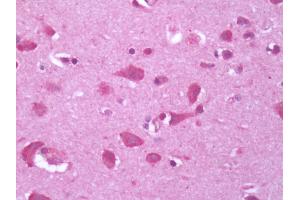 Human Brain, Cortex: Formalin-Fixed, Paraffin-Embedded (FFPE) (GPR34 抗体)