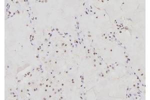 ABIN6276303 at 1/100 staining Human lung tissue by IHC-P. (DDIT3 抗体  (N-Term))
