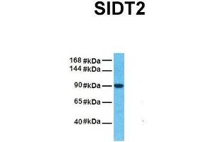 Host:  Rabbit  Target Name:  SIDT2  Sample Tissue:  Human Fetal Liver  Antibody Dilution:  1. (SIDT2 抗体  (N-Term))