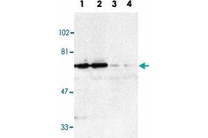 Western blot analysis of TNFRSF21 in K-562 (1, 3) and Raji (2, 4) whole cell lysate in the absence (1, 2) or presence (3, 4) of blocking peptide with TNFRSF21 polyclonal antibody  at 1 : 500 dilution. (TNFRSF21 抗体  (AA 42-56))