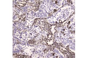 Immunohistochemistry (IHC) image for anti-Major Vault Protein (MVP) (AA 2-259) antibody (ABIN5692897)
