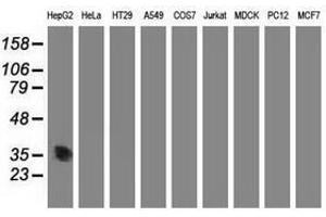 Image no. 3 for anti-Aminoacylase 3 (ACY3) antibody (ABIN1496464) (Aminoacylase 3 抗体)
