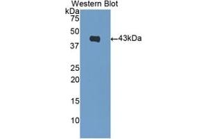 Detection of Recombinant BNP, Human using Polyclonal Antibody to Brain Natriuretic Peptide (BNP) (BNP 抗体  (AA 27-121))