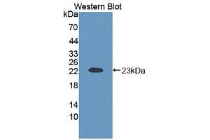 Western blot analysis of the recombinant protein. (ECT2 抗体  (AA 453-647))