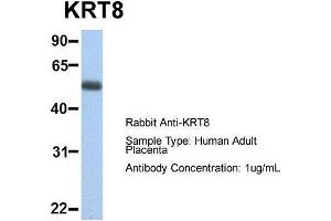 Host:  Rabbit  Target Name:  KRT8  Sample Type:  Human Adult Placenta  Antibody Dilution:  1. (KRT8 抗体  (Middle Region))