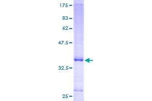 ZBTB7A Protein (AA 1-108) (GST tag)