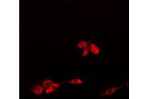 ABIN6275756 staining  HuvEC cells by IF/ICC. (SLC30A9 抗体  (Internal Region))
