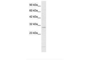 Image no. 2 for anti-RNA-binding protein Raly (RALY) (N-Term) antibody (ABIN6735882) (Raly 抗体  (N-Term))