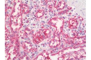 Immunohistochemistry (IHC) image for anti-Protein Phosphatase 1, Regulatory (Inhibitor) Subunit 11 (PPP1R11) antibody (Biotin) (ABIN1954881)