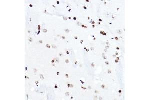 Immunohistochemistry (IHC) image for anti-E74-Like Factor 5 (Ets Domain Transcription Factor) (ELF5) (AA 1-170) antibody (ABIN6140130)