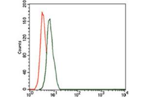 Immunohistochemical analysis of paraffin-embedded bladder cancer tissues using CD59 antibody with DAB staining. (CD59 抗体  (AA 31-111))