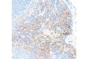 Immunohistochemistry (IHC) image for anti-Egf-Like Module Containing, Mucin-Like, Hormone Receptor-Like 1 (EMR1) (AA 28-225) antibody (ABIN7455124)