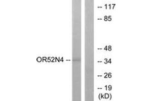 Western blot analysis of extracts from HeLa cells, using OR52N4 Antibody. (OR52N4 抗体  (AA 272-321))