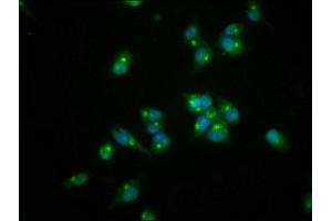 Immunofluorescence staining of SH-SY5Y cells with ABIN7167554 at 1:166, counter-stained with DAPI. (REG3A 抗体  (AA 27-175))