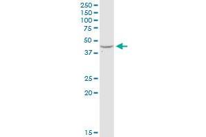 ADA MaxPab rabbit polyclonal antibody. (ADA 抗体  (AA 1-363))