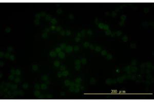 Immunofluorescence of monoclonal antibody to FOLH1 on K-562 cell . (PSMA 抗体  (AA 1-719))