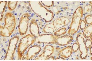 Immunohistochemistry of paraffin-embedded Human kidney using ST14 Ployclonal Antibody at dilution of 1:200. (ST14 抗体)