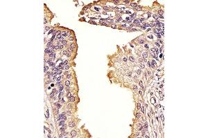 (ABIN388979 and ABIN2850435) staining SQSTM1 in Human prostate tissue sections by Immunohistochemistry (IHC-P - paraformaldehyde-fixed, paraffin-embedded sections). (SQSTM1 抗体  (AA 317-346))