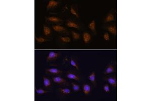 Immunofluorescence analysis of U-2 OS cells using RPS6K antibody (5718) at dilution of 1:100. (RPS6KA1 抗体  (C-Term))