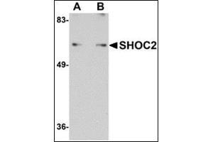 Western blot analysis of SHOC2 in Jurkat cell lysate with this product at (A) 1 and (B) 2 μg/ml. (SHoc2/Sur8 抗体  (N-Term))