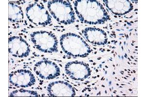 Image no. 2 for anti-Polo-Like Kinase 1 (PLK1) antibody (ABIN1500281) (PLK1 抗体)