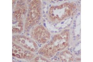 Immunohistochemistry (IHC) image for anti-Apolipoprotein E (APOE) antibody (ABIN6654012)