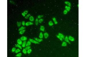 Figure:FITC staining on IHC-P;Simple: Hela cells (HCCS 抗体  (AA 1-268))