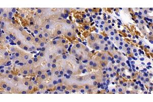 Immunohistochemistry (IHC) image for anti-Glycophorin A (GYPA) (AA 1-108) antibody (ABIN7441901)