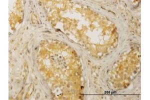 Image no. 3 for anti-CDC42 Binding Protein Kinase beta (DMPK-Like) (CDC42BPB) (AA 1580-1679) antibody (ABIN466151) (CDC42BPB 抗体  (AA 1580-1679))