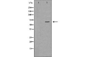Western Blotting (WB) image for anti-Golgi-Associated, gamma Adaptin Ear Containing, ARF Binding Protein 2 (GGA2) (C-Term) antibody (ABIN6261946)