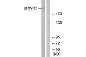 Western blot analysis of extracts from COLO cells, using BRWD3 Antibody. (BRWD3 抗体  (AA 1751-1800))