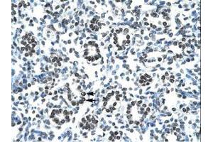 Image no. 1 for anti-Homeobox B9 (HOXB9) (AA 67-116) antibody (ABIN6735813) (HOXB9 抗体  (AA 67-116))