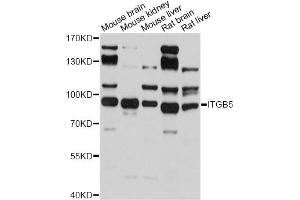 Western blot analysis of extracts of various cell lines, using ITGB5 antibody (ABIN5971332) at 1/500 dilution. (Integrin beta 5 抗体)