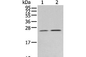 Western blot analysis of Human fetal brain tissue 231 cell using RAB11A Polyclonal Antibody at dilution of 1:400 (RAB11A 抗体)