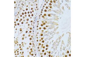 Immunohistochemistry of paraffin-embedded rat testis using SIRT1 antibody (ABIN5998812) at dilution of 1/100 (40x lens). (SIRT1 抗体)
