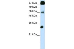 Western Blotting (WB) image for anti-CCCTC-Binding Factor (Zinc Finger Protein) (CTCF) antibody (ABIN2461796) (CTCF 抗体)