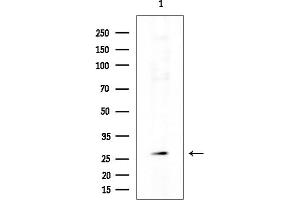 Western blot analysis of lysates from COLO205 cells(heat-shock treatment), using OR9G1 Antibody at 1/1000 dilution.