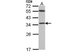 Western Blotting (WB) image for anti-Voltage-Dependent Anion Channel 2 (VDAC2) (C-Term) antibody (ABIN2855930)