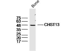 Mouse bone lysates probed with CHST13 Polyclonal Antibody, Unconjugated  at 1:300 dilution and 4˚C overnight incubation. (CHST13 抗体  (AA 151-250))