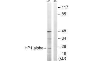 Western blot analysis of extracts from Jurkat cells, treated with insulin (0. (CBX5 抗体  (Ser92))