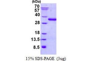 Ubiquitin Domain Containing 2 (UBTD2) protein (His tag)