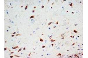 Immunohistochemical analysis of paraffin-embedded rat tissue sections (brain), staining SCDG3 in cytoplasm, DAB chromogenic reaction (SCG3 抗体  (C-Term))