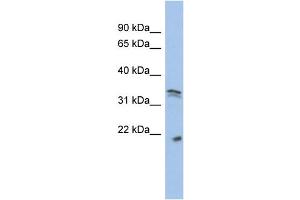 WB Suggested Anti-CDC2  Antibody Titration: 0. (CDK1 抗体  (Middle Region))