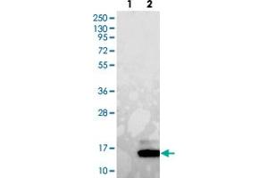Western blot analysis of Lane 1: Negative control (vector only transfected HEK293T lysate). (GUCA2A 抗体)