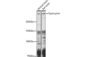 Western blot analysis of extracts of various cell lines, using Dystrophin antibody (ABIN1679546, ABIN3015473, ABIN3015474 and ABIN6218357) at 1:1000 dilution. (Dystrophin 抗体  (AA 346-635))