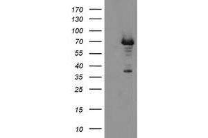 HEK293T cells were transfected with the pCMV6-ENTRY control (Left lane) or pCMV6-ENTRY PGM3 (Right lane) cDNA for 48 hrs and lysed. (Phosphoglucomutase 3 抗体)