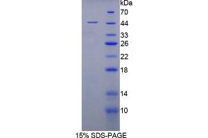 SDS-PAGE analysis of Rabbit MSE Protein. (MSE 蛋白)
