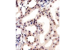 Immunohistochemical analysis of paraffin-embedded H. (CSNK2A1/CK II alpha 抗体  (AA 250-284))