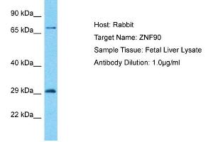 Host: Rabbit Target Name: ZNF90 Sample Type: Fetal Liver lysates Antibody Dilution: 1. (ZNF90 抗体  (C-Term))